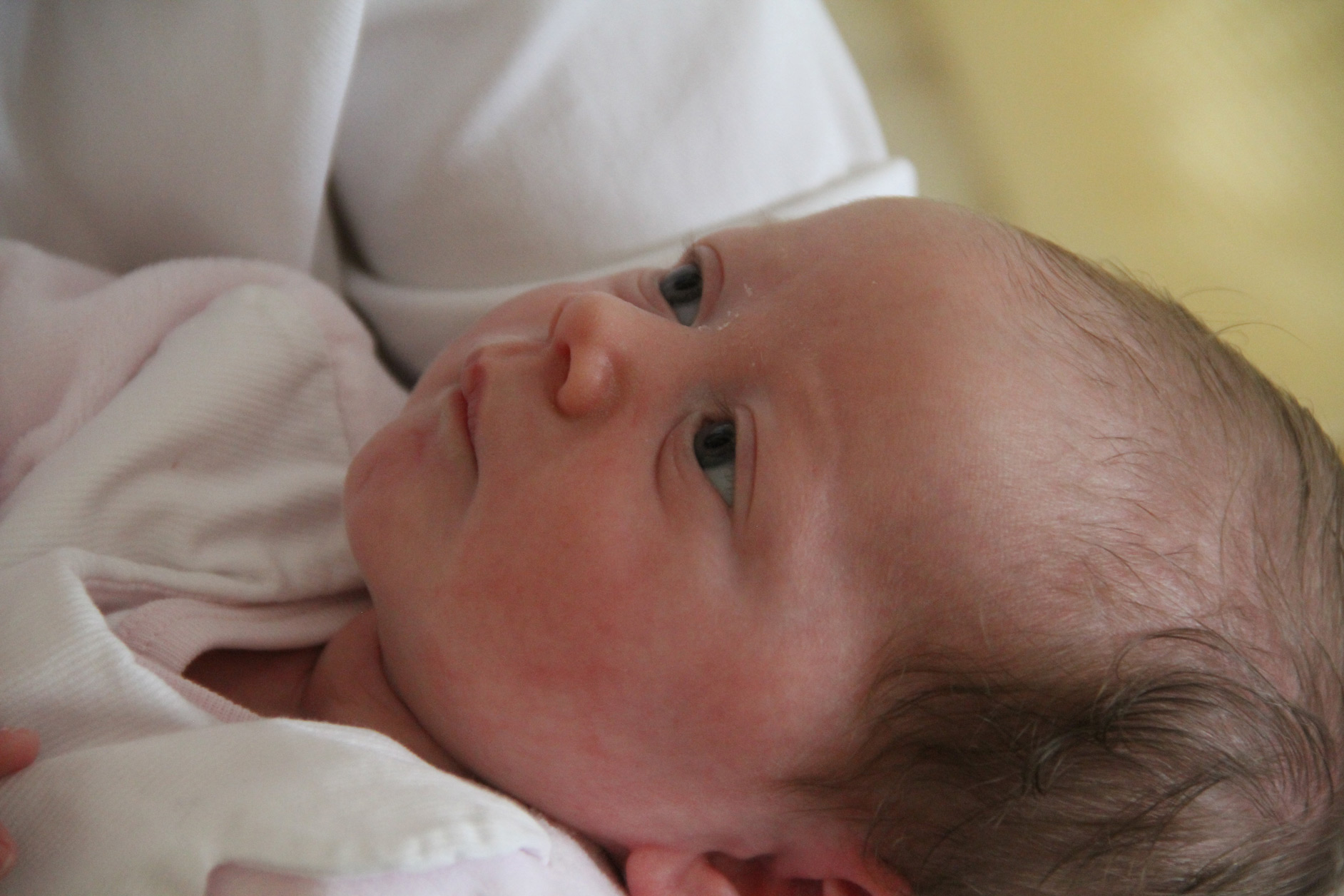 Crane Deforme Tete Plate De Bebe Plagiocephalie Mpedia Fr