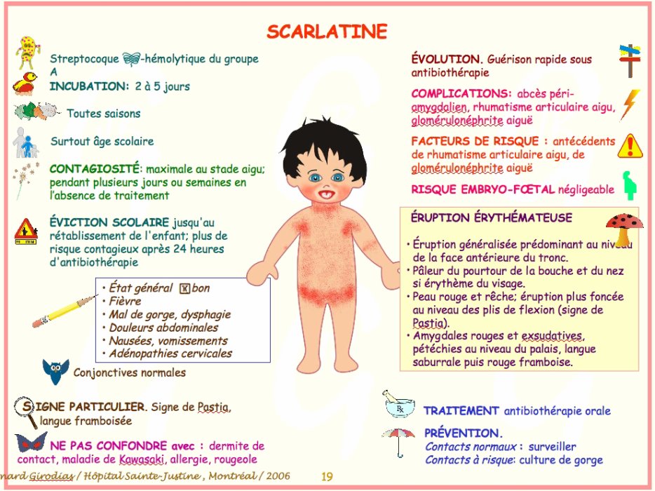 La scarlatine : définition, symptômes et traitement - mpedia.fr