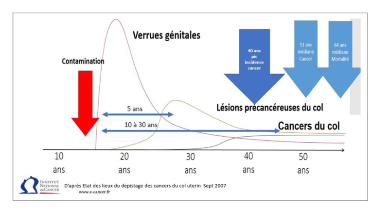 Hpv homme symptome