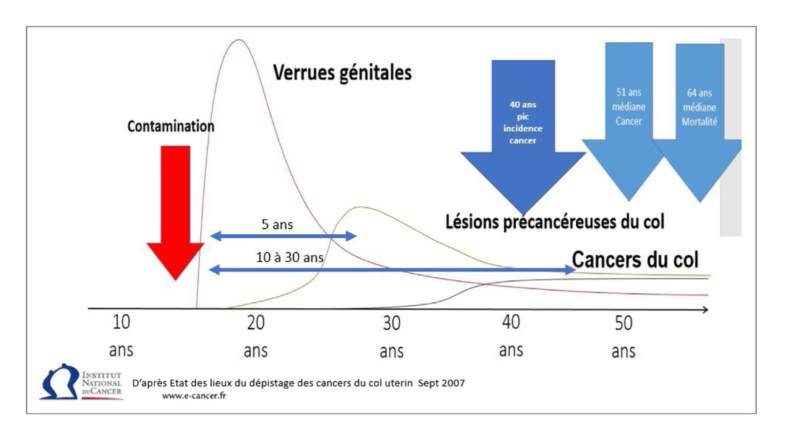 Cycle Cancer Infections Lésions