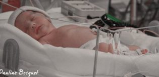 La Mise En Place De L Allaitement D Un Bebe Premature Mpedia Fr