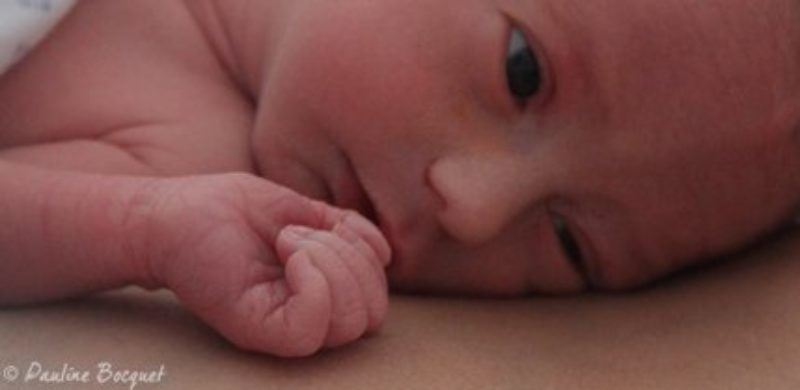 Peau De Bebe Problemes Et Maladies De Peau Chez L Enfant Mpedia Fr