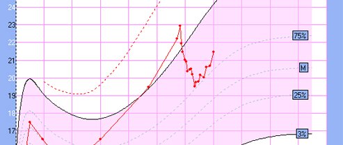 Imc Comprendre Les Courbes De Poids Et De Croissance Mpedia Fr